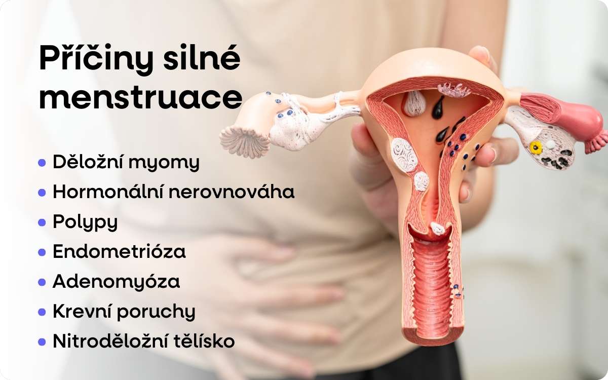 priciny silne mestruace